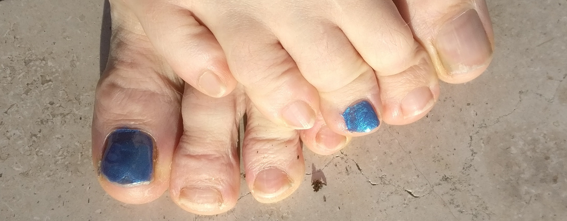 Mein Bunter Zeh geht um  die Welt